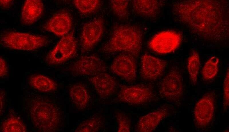 En este momento estás viendo Estudian la incorporación de la nanotecnología en tratamientos de cáncer de piel<p class = "resumen">El proyecto pretende mejorar la calidad de vida de las y los pacientes.</p>